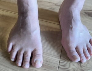 足爪のカウンセリング