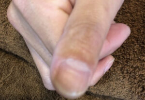 爪の横線 爪の横溝の原因