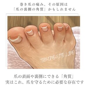 爪の表面や裏側にできる「角質」。 実はこれ、爪を守るために必要な存在です。