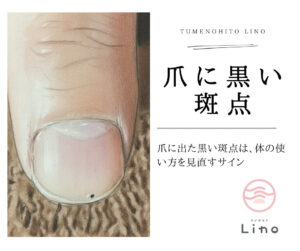 爪に現れた黒い斑点の状態を示したイメージ。爪の下で起きる小さな出血について解説するブログの挿絵