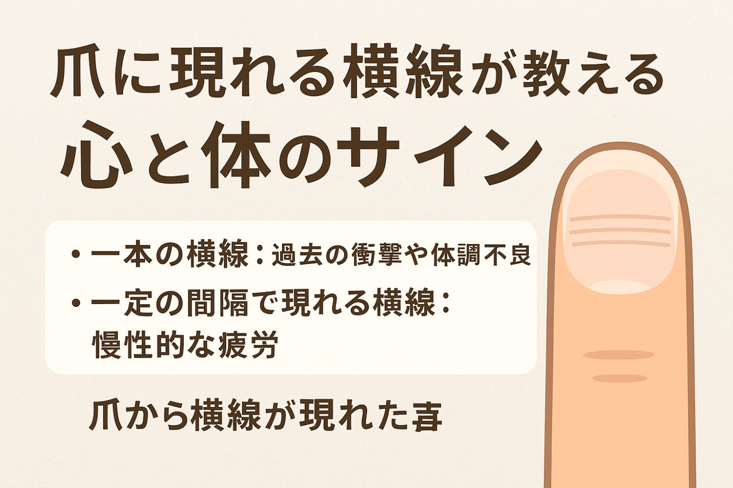 爪の横線でわかる！ストレスと疲労の見えないサイン | 爪を本来の …